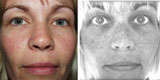 Photo and skin scan showing hidden damage, Richmond VA