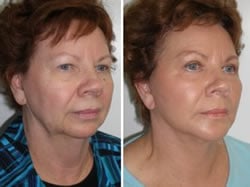 Review for Dr Niamtu