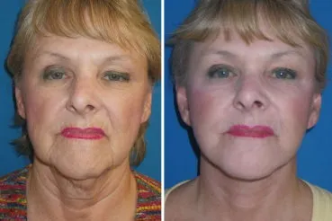 featured makeovers
