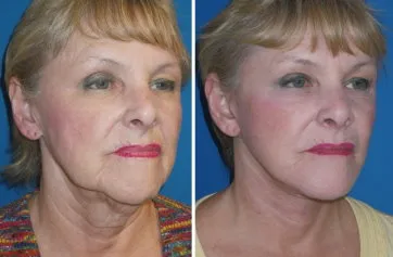 featured makeovers