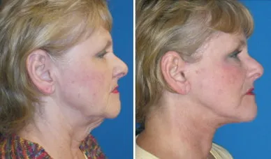 featured makeovers