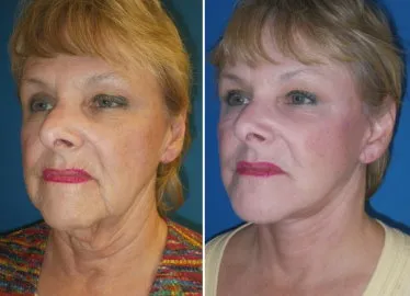 featured makeovers