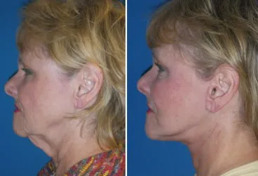 featured makeover