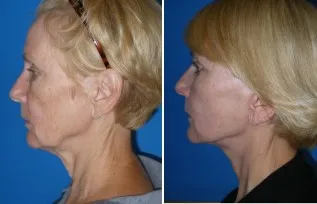 featured makeovers