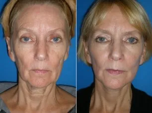featured makeovers