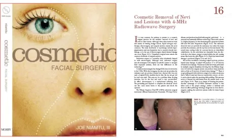 Mole Removal