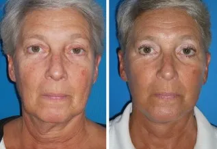 featured makeovers