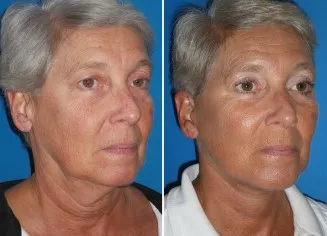 featured makeovers