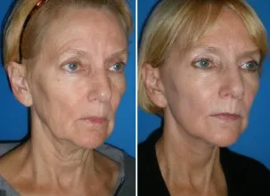 featured makeovers