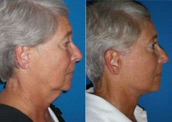 featured makeovers