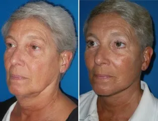 featured makeovers
