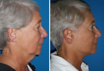 featured makeovers