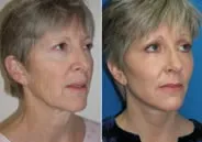 featured makeovers