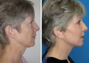 featured makeovers