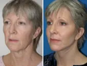 featured makeovers