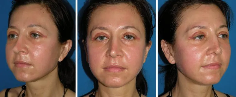 photos of a female face