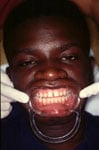 Charitable Surgeries