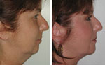 Review for Dr Niamtu