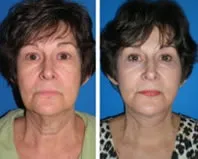 featured makeovers