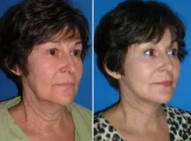 featured makeovers