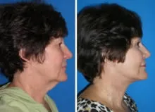 featured makeovers