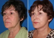 featured makeovers