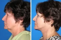 featured makeovers