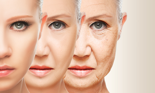 Facial Aging