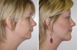 Review for Dr Niamtu