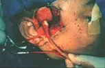 Charitable Surgeries