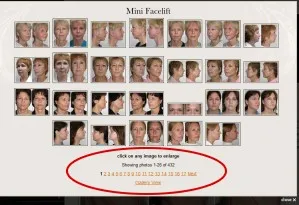 about before & after photos