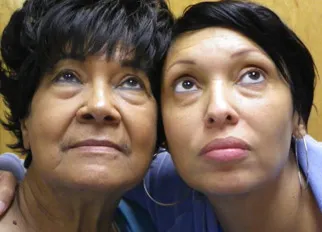 Mother and daughter with hereditary lower eyelid bags