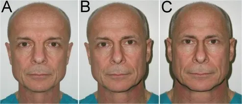 showing that the face is NOT symmetrical