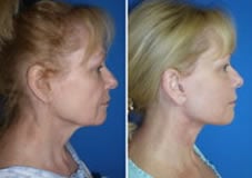 Review for Dr Niamtu