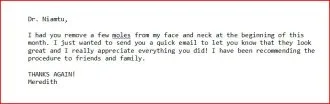 Mole Removal Review in Richmond, VA