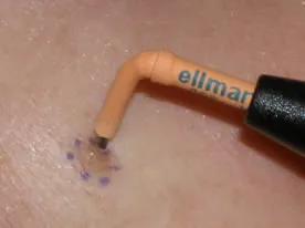 Mole Removal in Richmond, VA