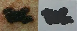 b = Border Irregular (border not round or distinct)