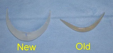 Chin & Lower Facial Implants