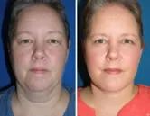 featured makeovers