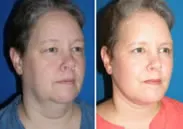 featured makeovers