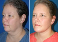featured makeovers