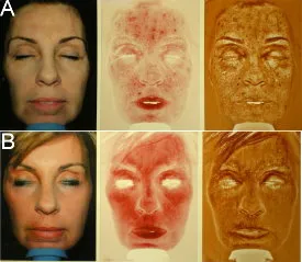 The sun damage is not visible with the naked eye