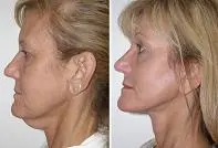 featured makeovers