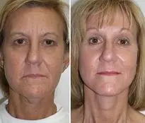 featured makeovers