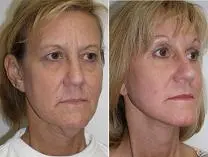 featured makeovers