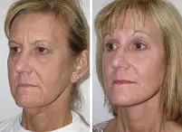 featured makeovers