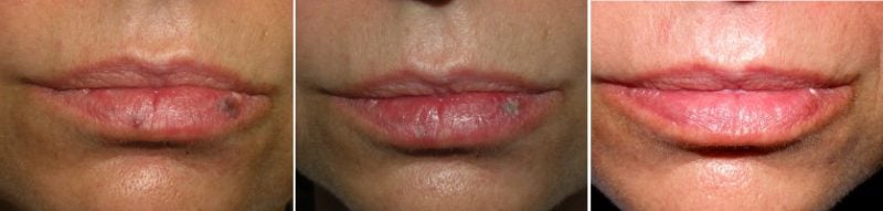 photos of lips
