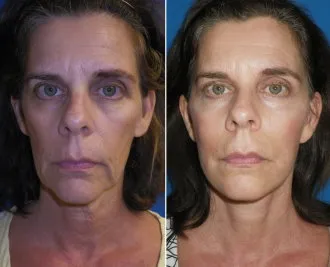 featured makeovers