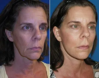 featured makeovers