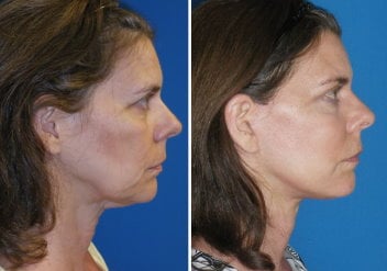 featured makeovers